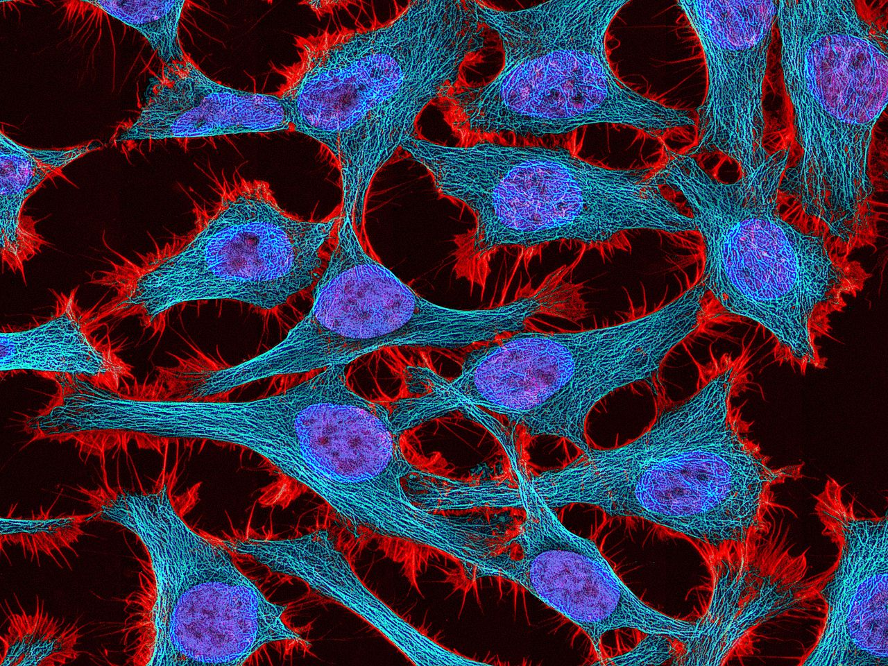 HeLa cells stained with the actin binding toxin phalloidin (red), microtubules (cyan) and cell nuclei (blue). Source: NIH [public domain]